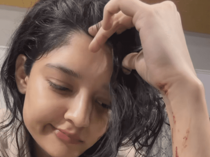 Ritika Singh injured in Rajinikanth’s film shooting